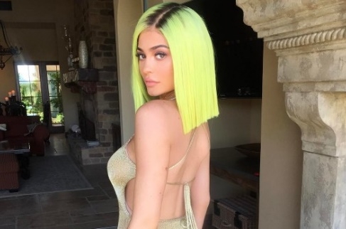 ​ Guys, she has guts to set her style.Kylie goes fluorescent  Neon!