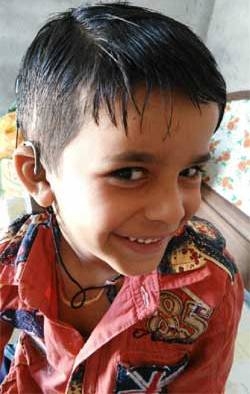 Now 6-year-old Adarsh can talk and hear like other children