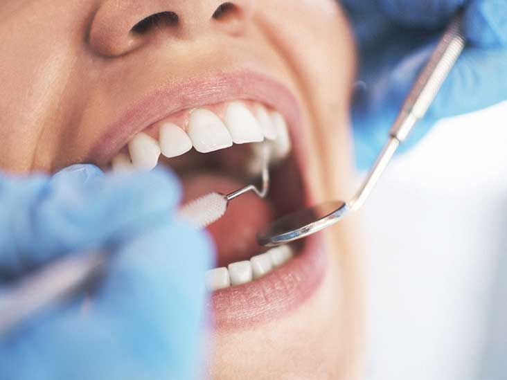  Lack of good oral health may up hypertension risk 