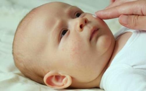  6 ways to manage dry and itchy skin in babies 