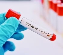 Coronavirus infection sets to the biggest challenge for doctors and scientists at this time