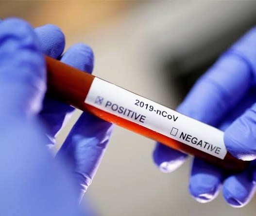 A report claims; After May 15, the effect of the Coronavirus infection to decrease in India