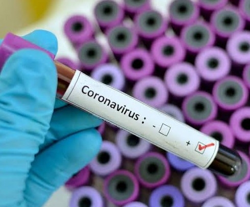 Avoid Coronavirus infection by following social distancing at home too!