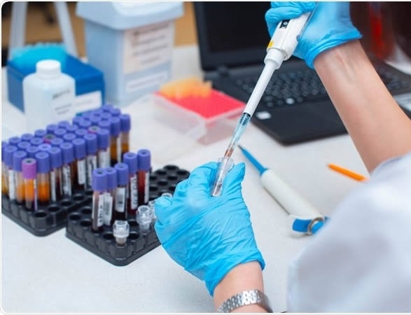 So, the risk of getting infected again from Coronavirus after being recovered increasing?