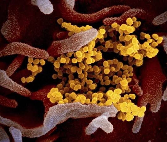  So do the patients without symptoms from COVID-19 spread the infection more quickly?