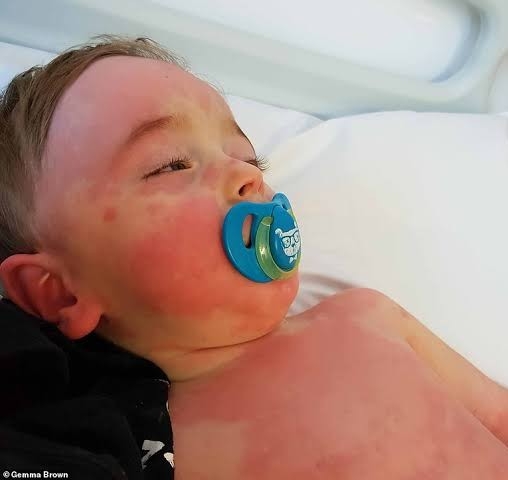 Be careful! 'This syndrome' linked to COVID-19 making children sick