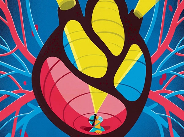  Cardiologists call for latest interventional heart technologies 