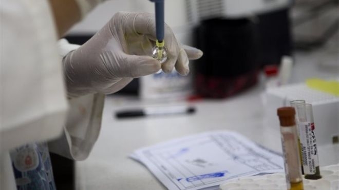  Experimental Zika vaccines protect foetus against infection 