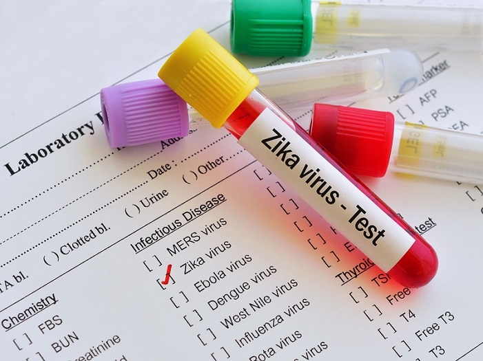  New paper-based test can diagnose Zika in 20 minutes 