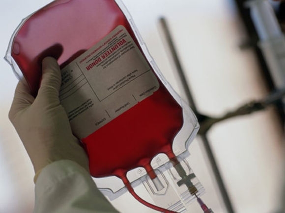  Previously pregnant donor may up death risk in men 