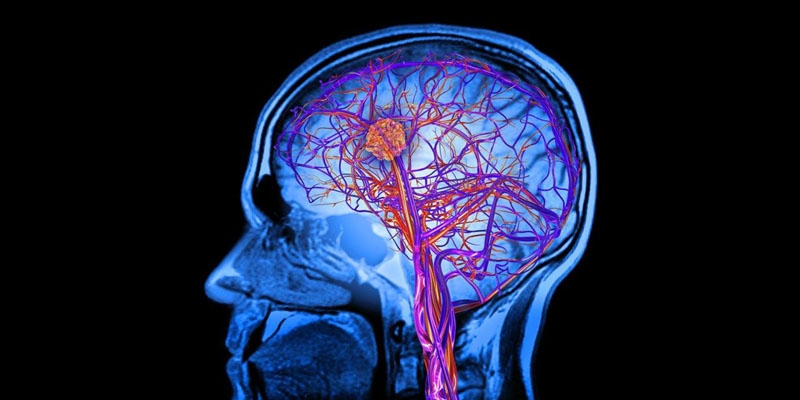  AI may help evaluate brain maturity in preterm infants 